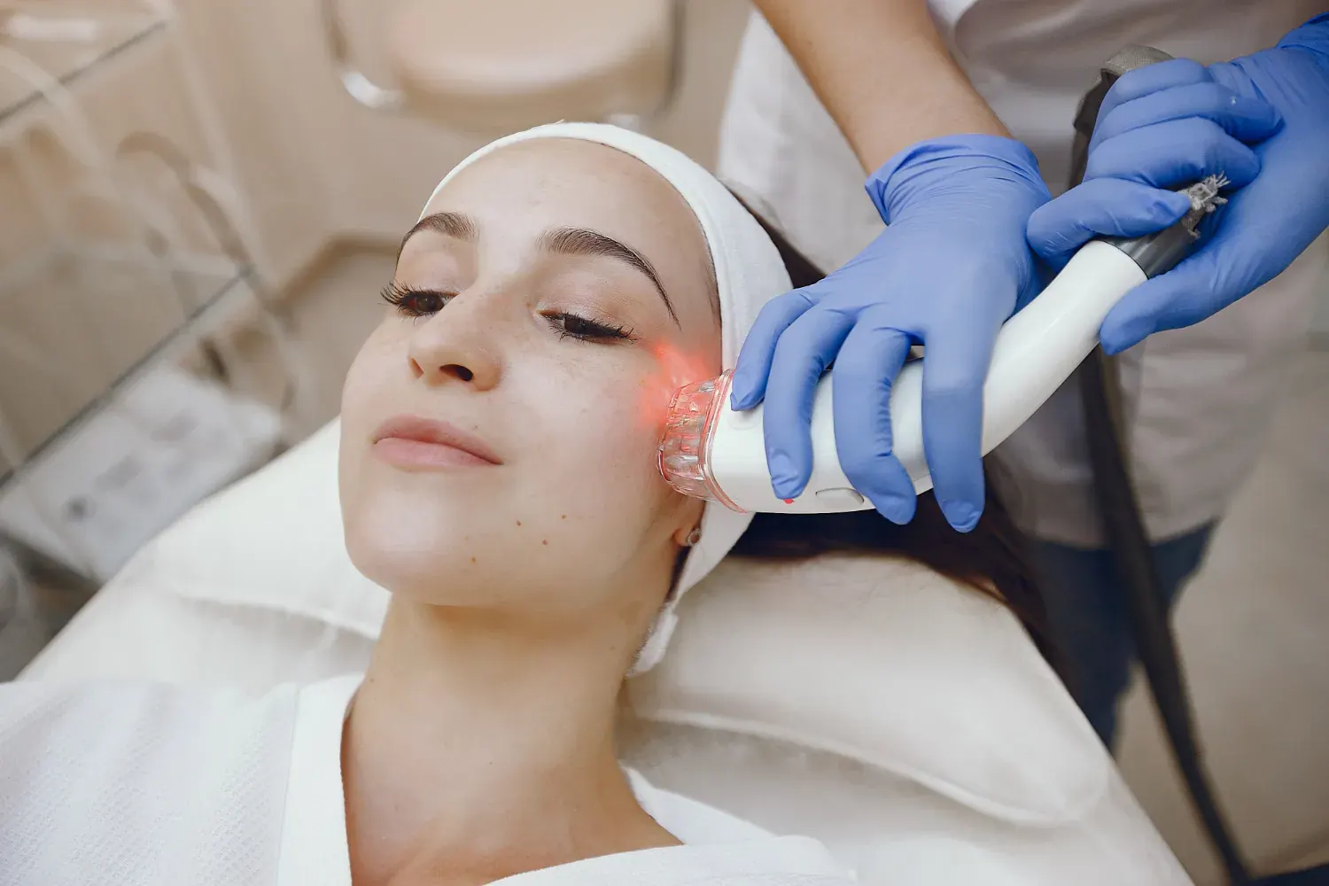 Sylfirm X RF Microneedling device handpiece treating facial skin in London