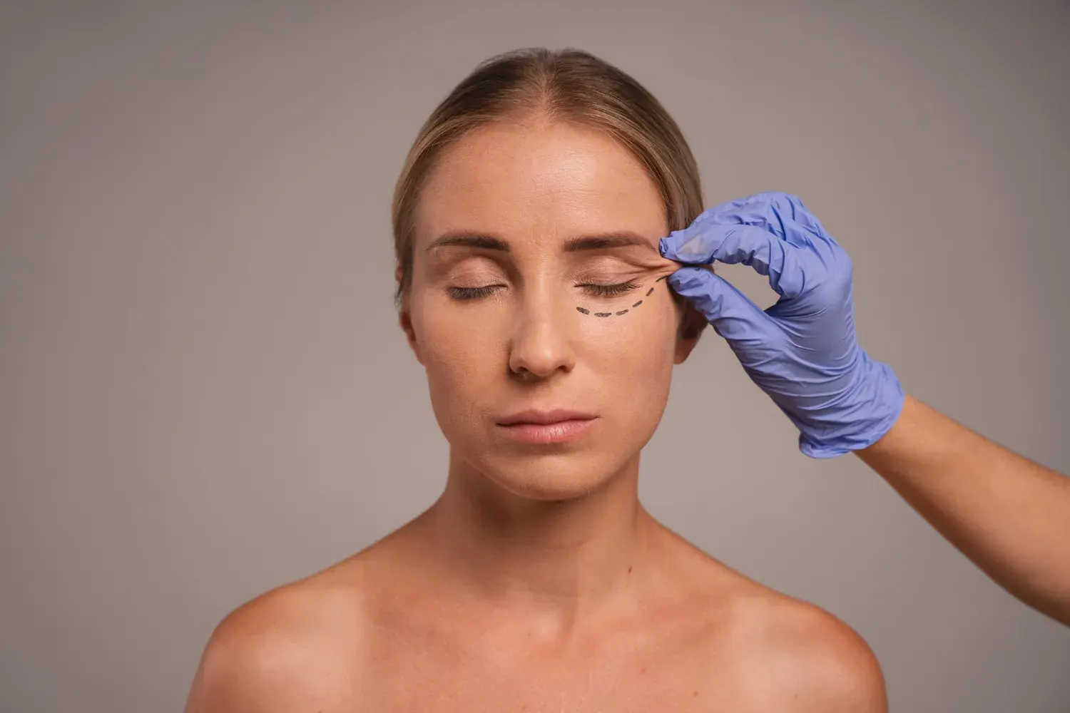 Before and after concept for tear trough filler treatment reducing under eye hollows in London